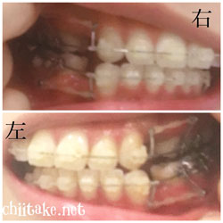 フックとパワーチェーン 201805-01