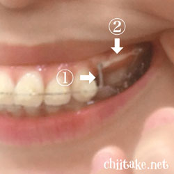 フックとパワーチェーン 201805-02