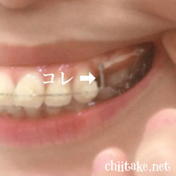 フックとパワーチェーン 201805-03