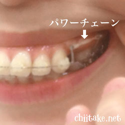 フックとパワーチェーン 201805-04