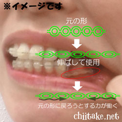 フックとパワーチェーン-パワーチェーンの効果 201805-05