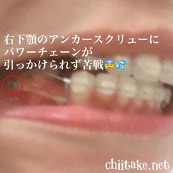 フックとパワーチェーン 201805-06